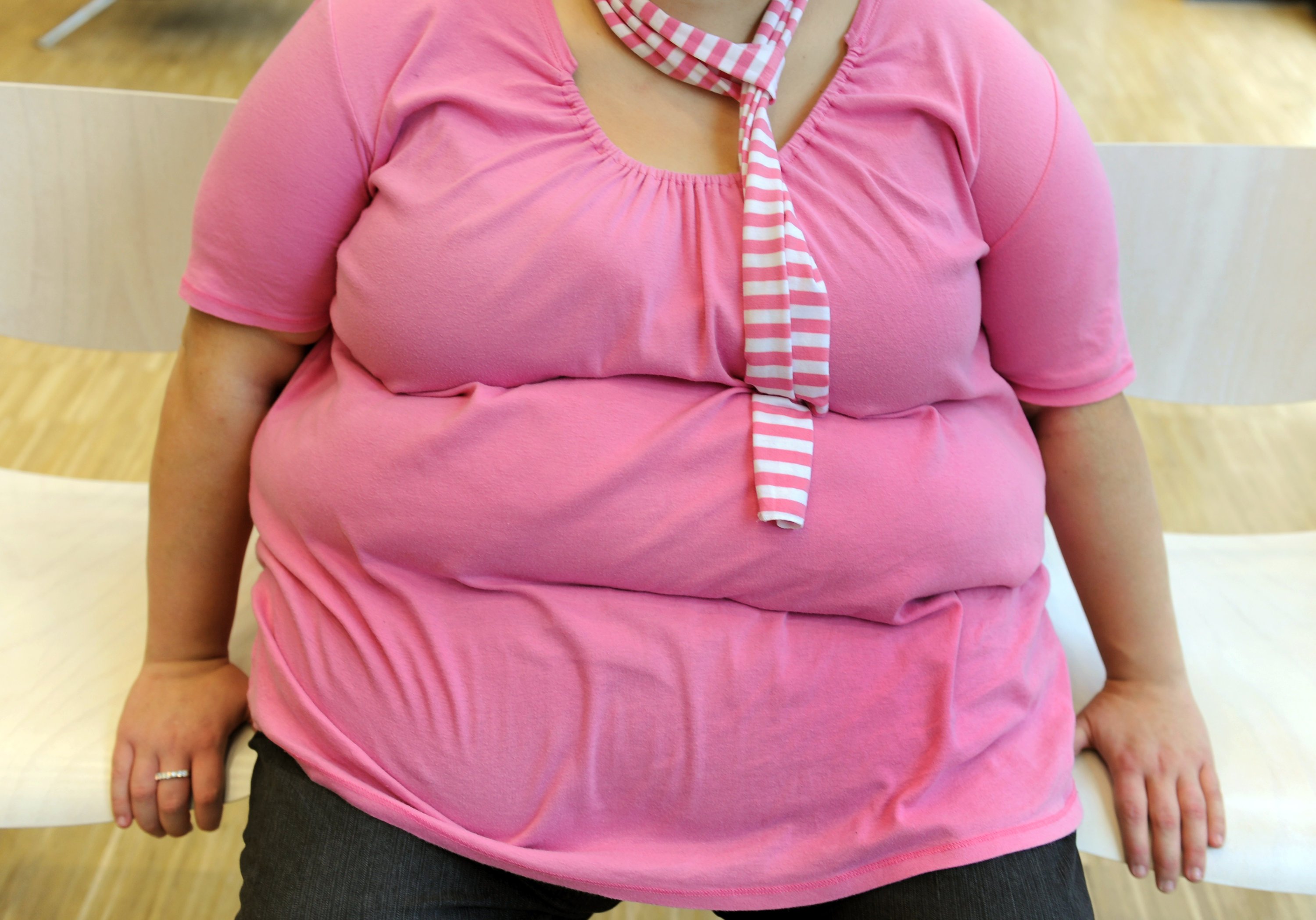 Живот толстухи. Женщина с избыточным весом.