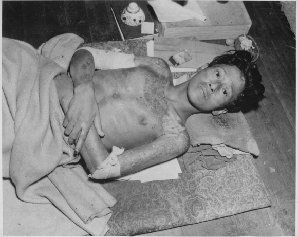  Жертва американских бомбардировок в католическом соборе Нагасаки.   Источник: Национальный архив США.