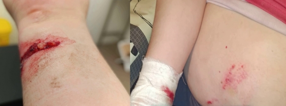 Ответственность за нарушение правил содержания и выгула собак, особенно опасных пород, нужно серьёзно ужесточать Ответственность за нарушение правил содержания и выгула собак, особенно опасных пород, нужно серьёзно ужесточать